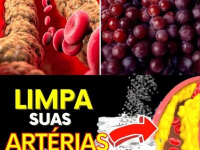 10 INCRÍVEIS ALIMENTOS QUE LIMPAM seus VASOS SANGUÍNEOS | MELHORA A CIRCULAÇÃO (E OS 5 PROIBIDOS)