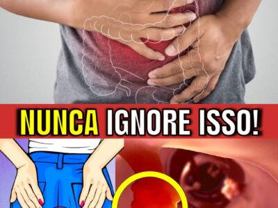 7 SINTOMAS de ALERTA de CÂNCER DE INTESTINO que você NUNCA PODE IGNORAR!